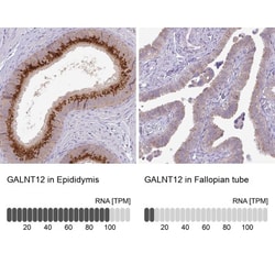 GALNT12 Antibody, Novus Biologicals:Antibodies:Primary Antibodies